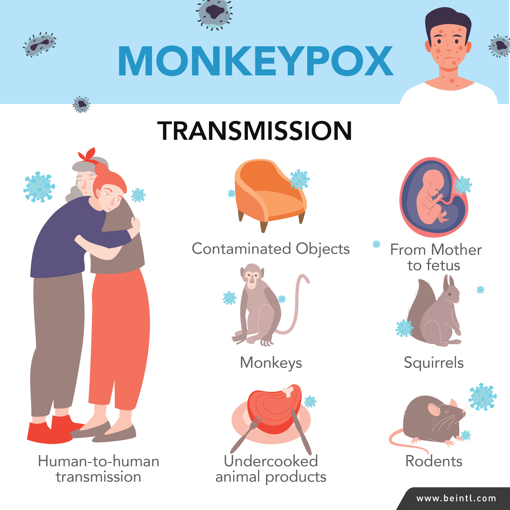 Monkeypox Outbreak: Understanding Symptoms, Risks, and Prevention Methods