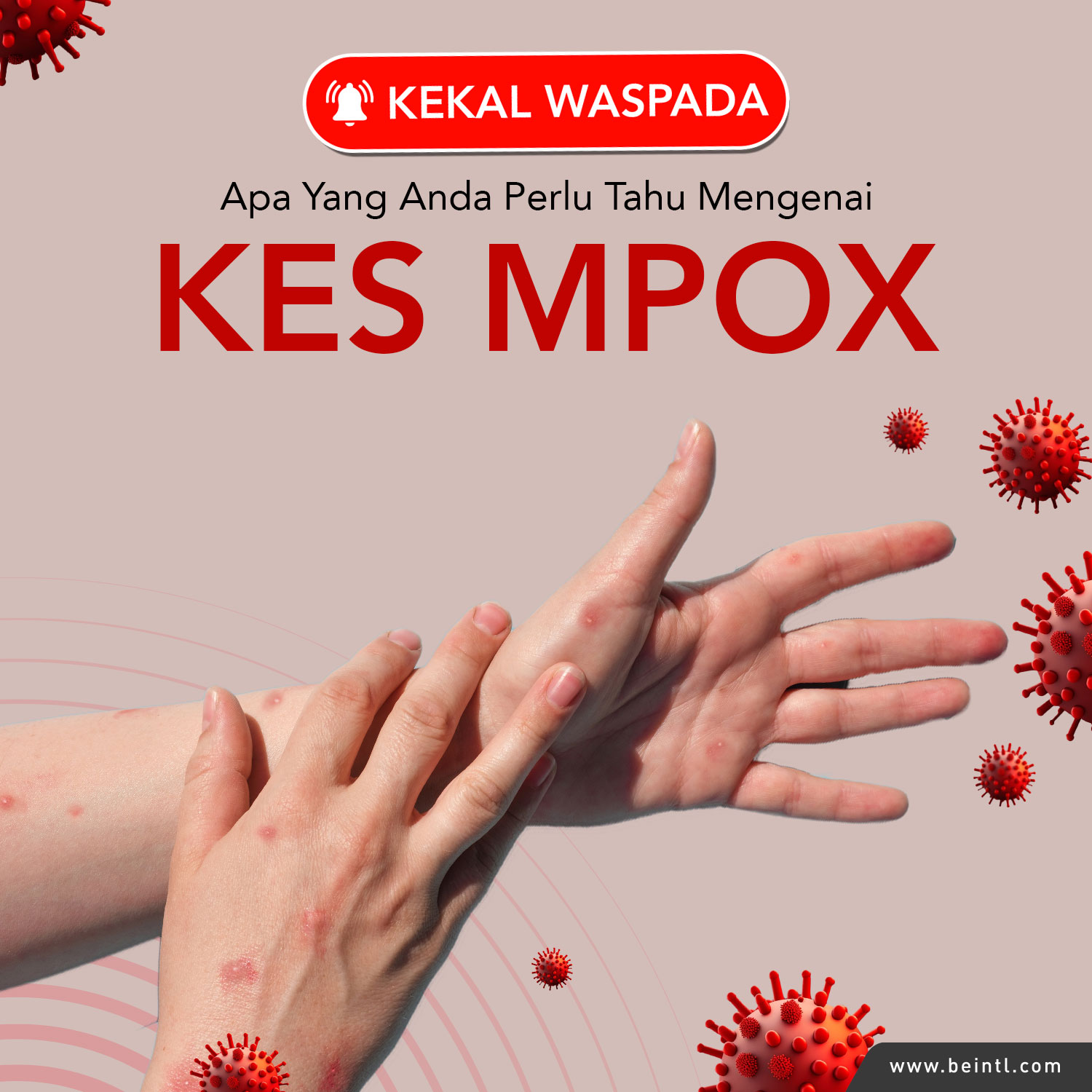 KEKAL WASPADA: Apa Yang Anda Perlu Tahu Mengenai Kes Mpox Terkini di Malaysia